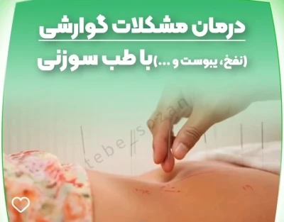 درمان مشکلات گوارشی با طب سوزنی