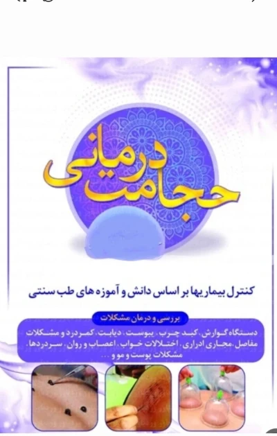 حجامت سنتی و چینی