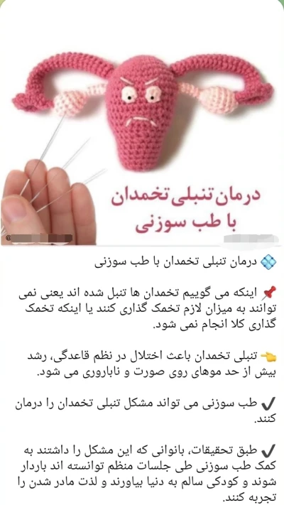 طب سوزنی تخمدان