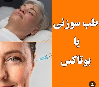 تفاوت بوتاکس و طب سوزنی ...