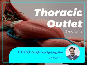 متلازمة مخرج الصدر (TOS)